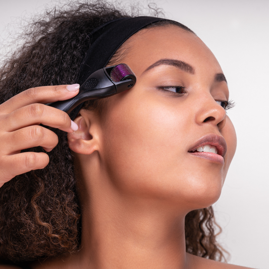 Derma Roller: mi varita mágica de belleza para la piel.